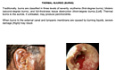 Diseases Of The Ear Volume1 The Pinna
