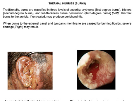 Diseases Of The Ear Volume1 The Pinna