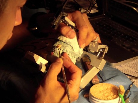 Diagnostic Waxup Part 10