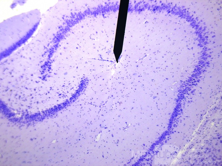 Hippocampal Formation