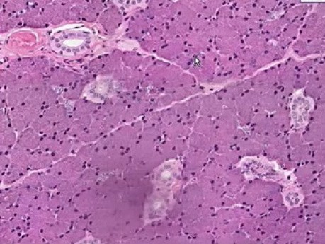 Parotid Gland - Histology