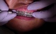 Powerchain - Ortho Update (Patient Mr)