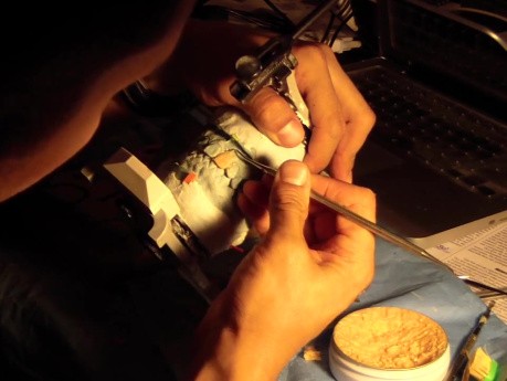 Diagnostic Waxup Part 7