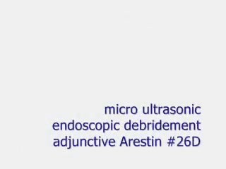 Dealing With Perioscope