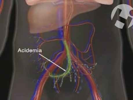 Cardiovascular Effects