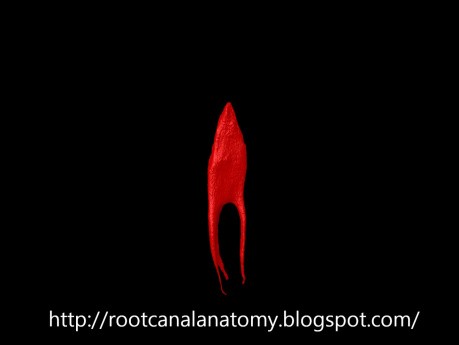 Mandibular First Premolar - Root Canal Anatomy