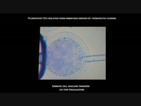 Potential Sources of Stem Cells