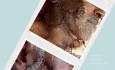 Male patient with a long-standing volume increase in the right parotid region