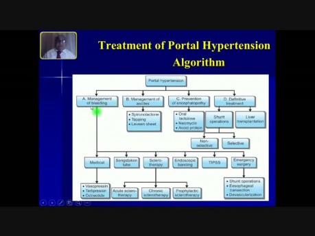 Upper GI Bleeding - Variceal Bleeding