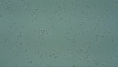 Autoimmune process