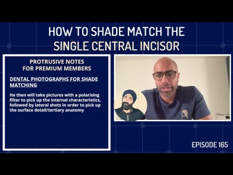 How to Shade Match the Single Central Incisor 