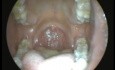 Oral Cavity and Oropharynx-The Panoramic View