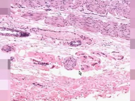 Gastro-Esophageal Junction - Histology