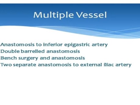 Robotic Kidney Transplant with Total Extraperitonealisation of the Graft