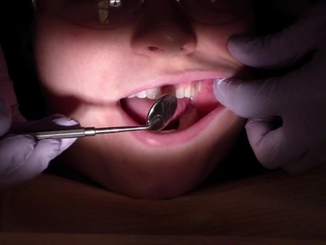 Dental Isolation - Cotton Rolls And Dri - Angles