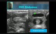 IHPS - Infantile Hypertrophic Pyloric Stenosis