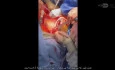 Complex Multi Organ Donation Version 2 - Another Aspect