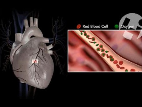 Normal Coronary Anatomy and Physiology