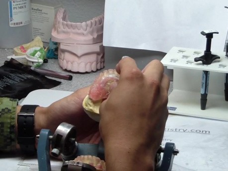 Duplicate Existing Denture To Speed Mounting Final Casts.Don'T Tell Your Prostho Instructor!