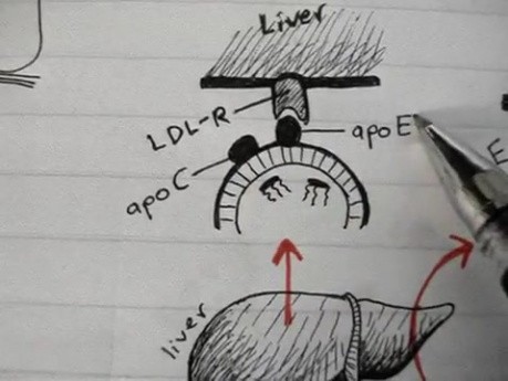 Chylomicron - Lipoprotein Physiology Lecture
