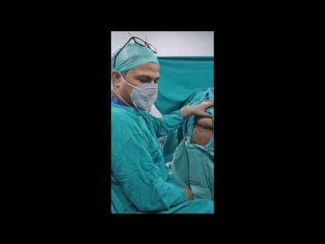 Pilonidal Sinus with Fistula in Ano - Recurrent pilonidal Sinus Can be Covert Fistula in ano.
