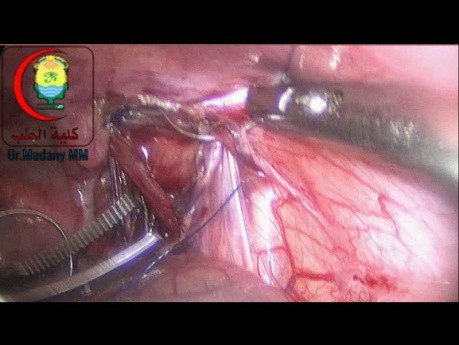 What's The Name of This Type of Suturing