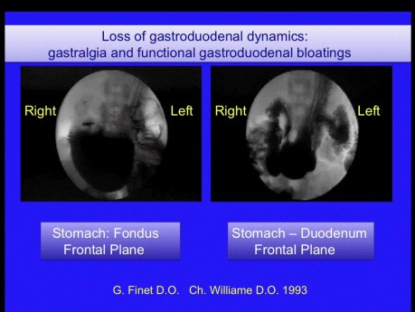Osteopathic Approach to Visceral Dynamics