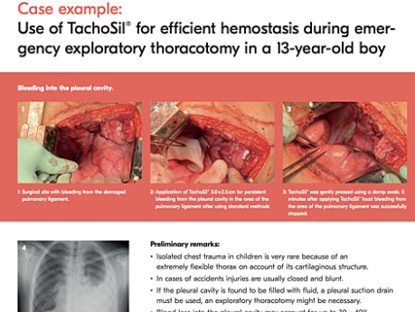 Use of TachoSil® for Efficient Hemostasis During Emergency Exploratory Thoracotomy in a 13-year-old Boy
