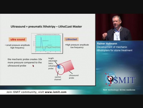 Development of Mechanic Lithotripsters for Stone Treatment - SMIT 2019