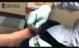 Gout Lesion Drainage - Foot