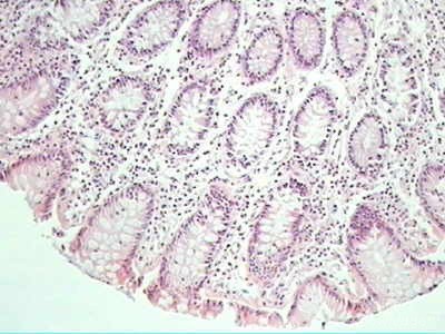 Trichuris Trichuris (whipworm) (19 of 19)