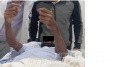 Cloward's Anterior Approach for AO Spine Type C Cervical Fracture with Brown Sequard Syndrome