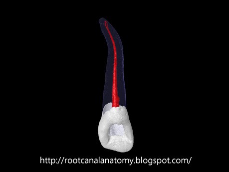 Maxillary Lateral Incisor - Root Canal Anatomy