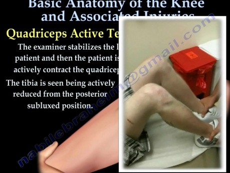 Knee Anatomy and Injuries