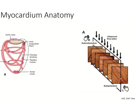A Practical Guide to Echocardiographic Global Longitudinal Strain (GLS) by 2D Speckle Tracking