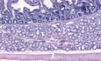 Gastro-Duodenal Junction - Histology