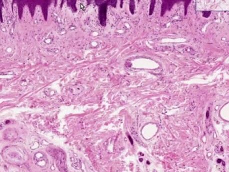 Thick Skin - Histology