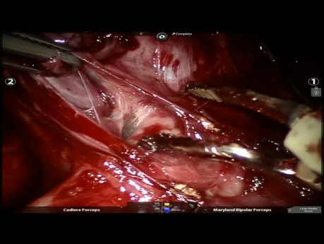 Cystic Pulmonary Lesion