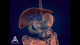 whipple procedure animation