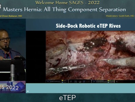 Masters Hernia: All Thing Component Separation - eTEP