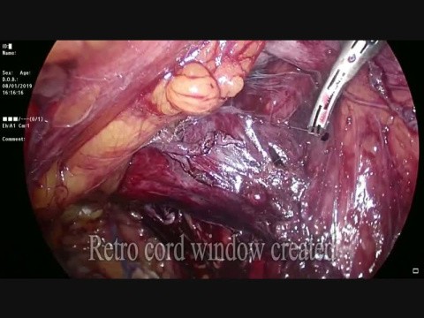 Hernia Surgery Highlights