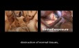 Surgical Videos for Anatomy