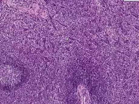 Spleen - Histology