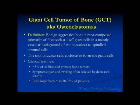 Orthopedic Oncology Course - Radiolucent Lesions of Bone (GCT, ABC, UBC) - Lecture 7