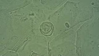 Vagina - Epithelial cells