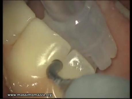 Preliminary Visit - Oral Hygiene
