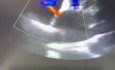  A Residual ASD After Septostomy 