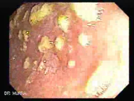 Rectum (5 of 30)