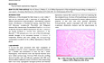 Diffuse Lipomatosis of Thyroid Gland Masquerading as Malignancy