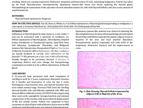 Diffuse Lipomatosis of Thyroid Gland Masquerading as Malignancy